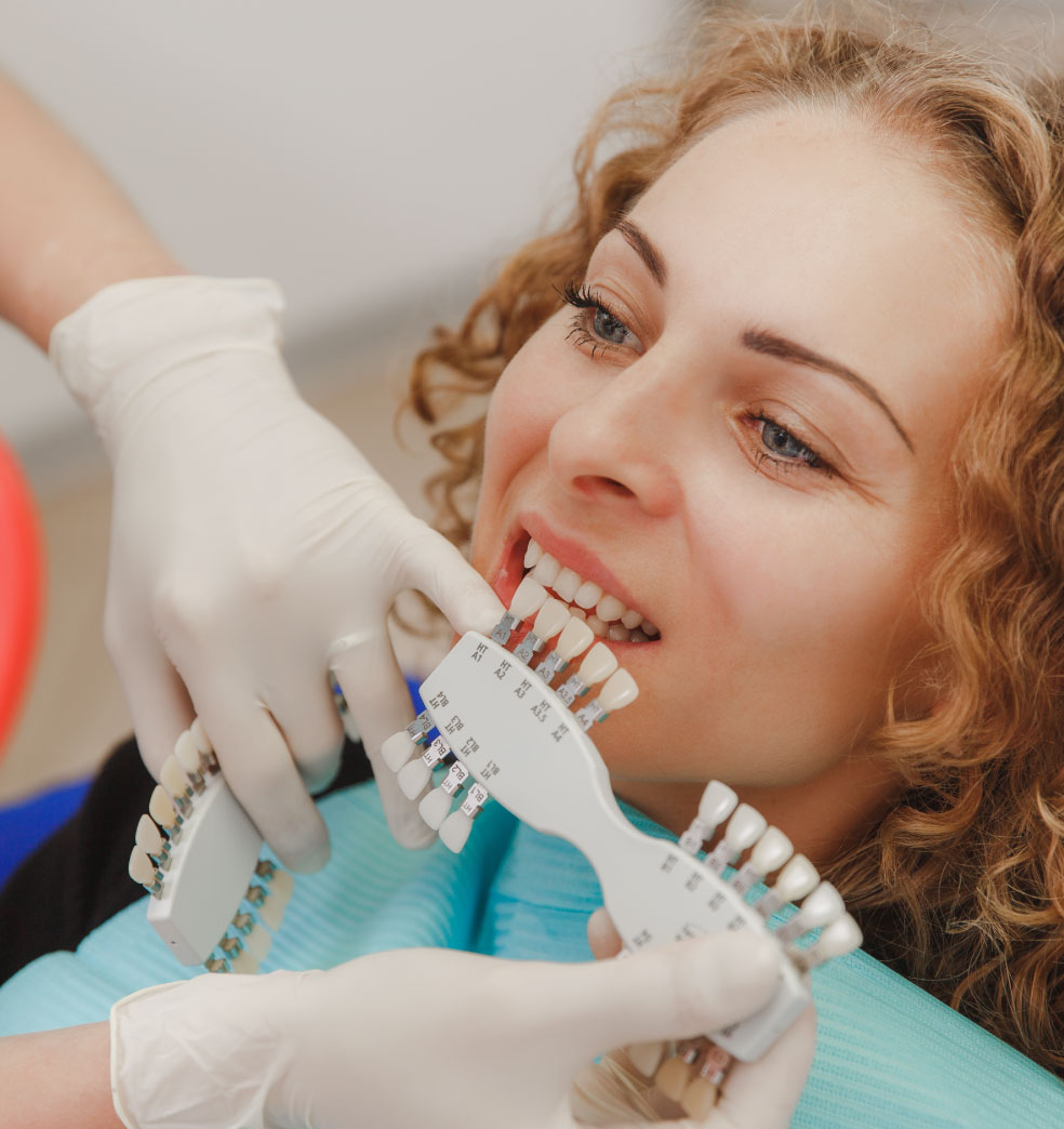 Carillas y lentes de contacto dentales: Indicaciones y Contraindicaciones