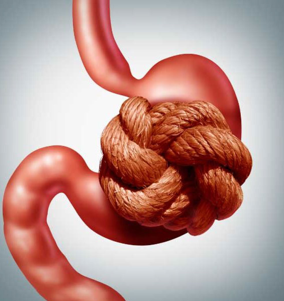 Causas de la constipación?