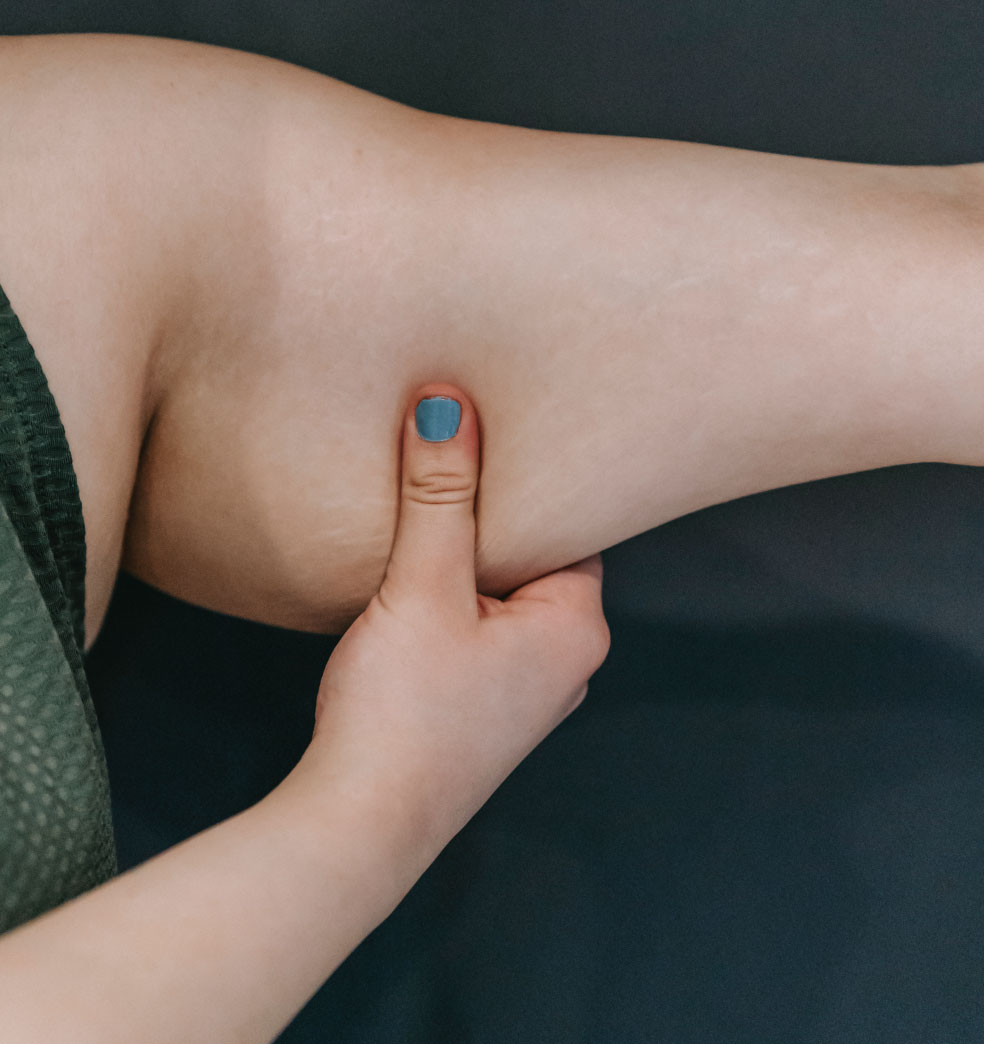 Cirugías de contorno corporal tras pérdidas importantes de peso