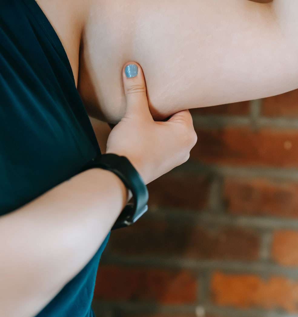 Cirugías estéticas de los miembros?