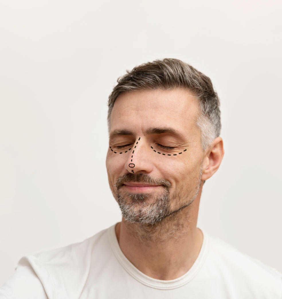 Cirugías estéticas en hombres