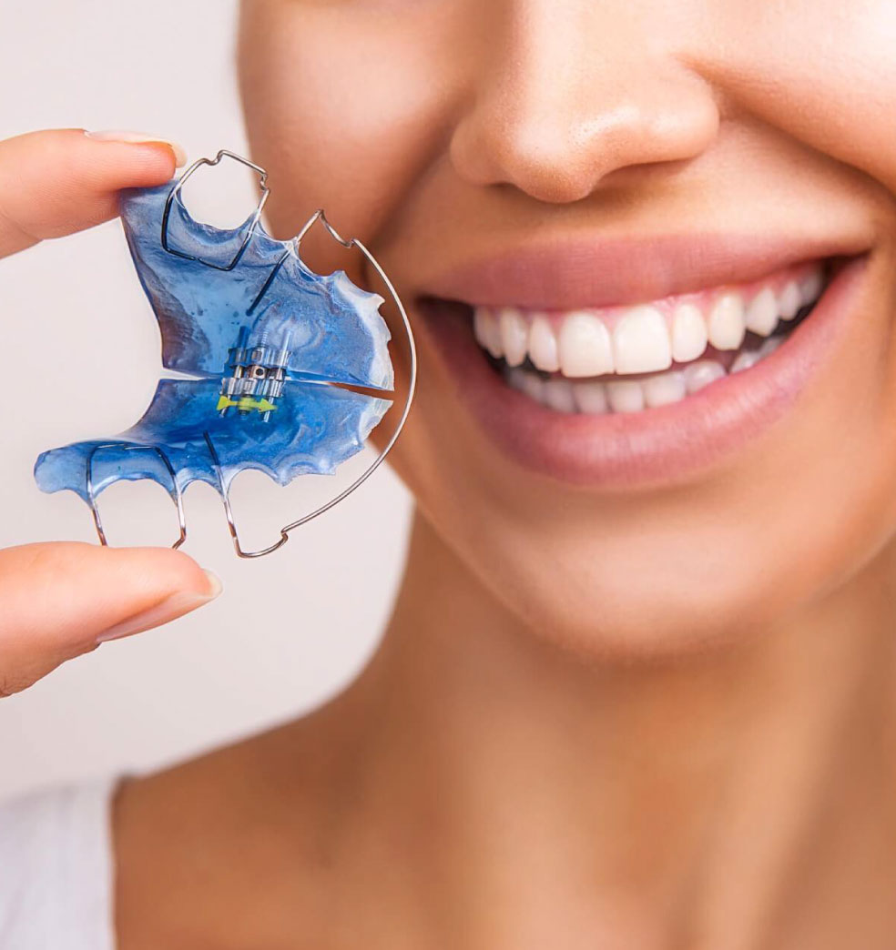 Cómo cuidar las placas de contención o retenedores