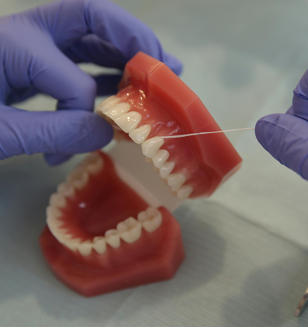 Cómo debe ser la higiene de los implantes dentales
