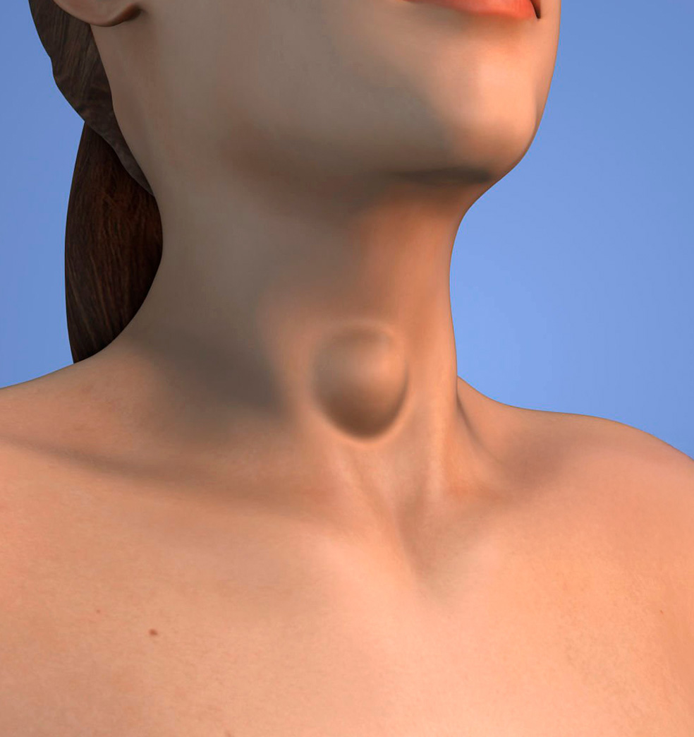 Como proteger la tiroides