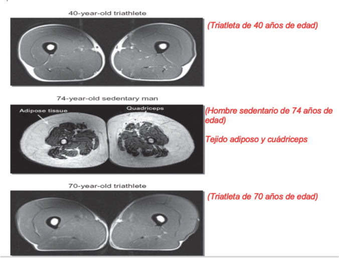 envejecer sin dolor