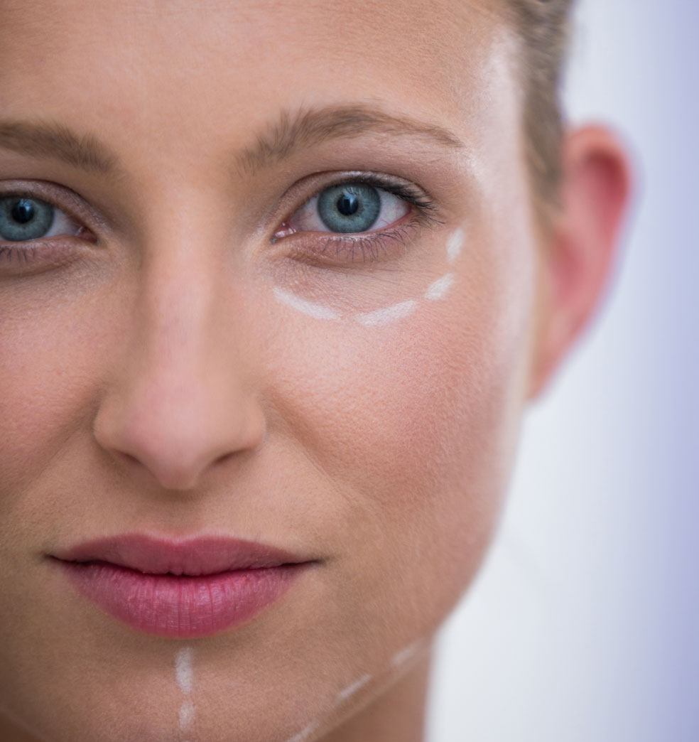 El rejuvenecimiento facial integral?