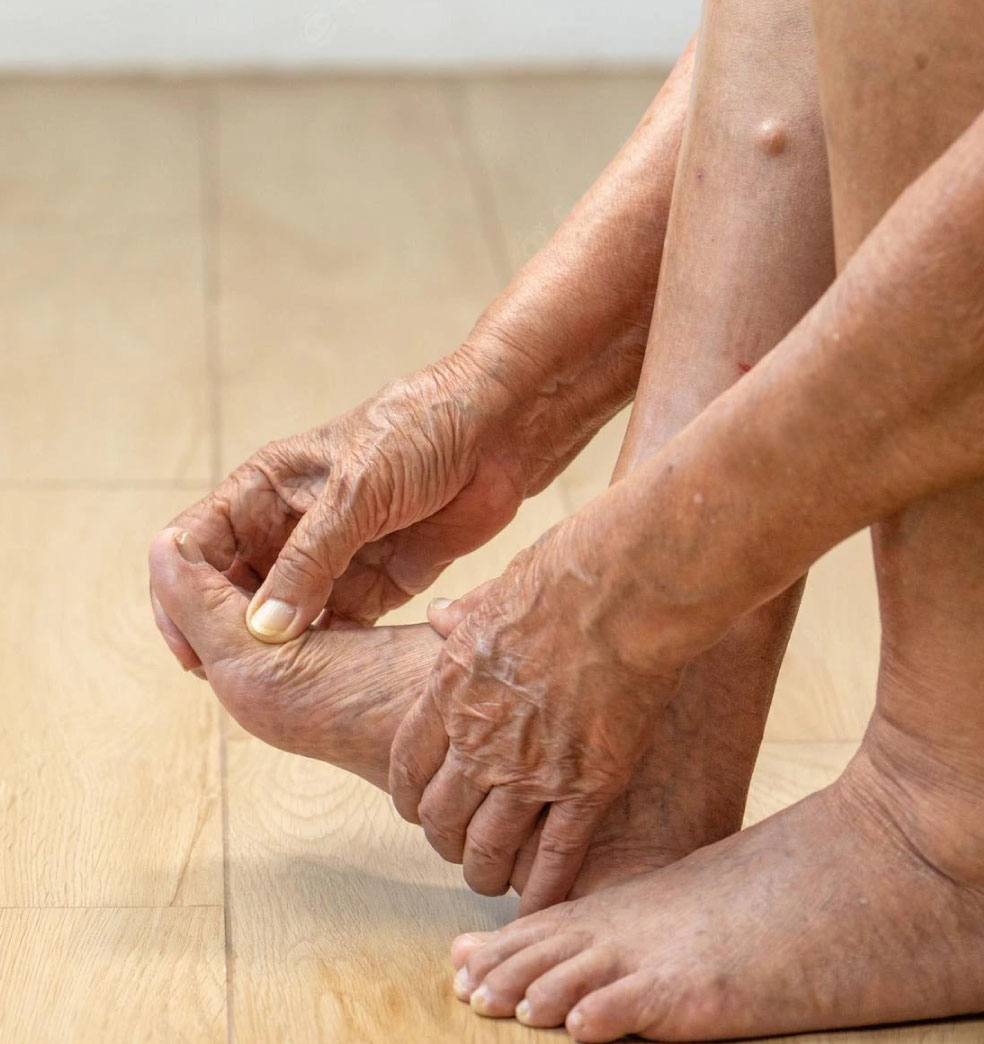 Terapias alternativas para reducir la hinchazón de piernas en adultos mayores?