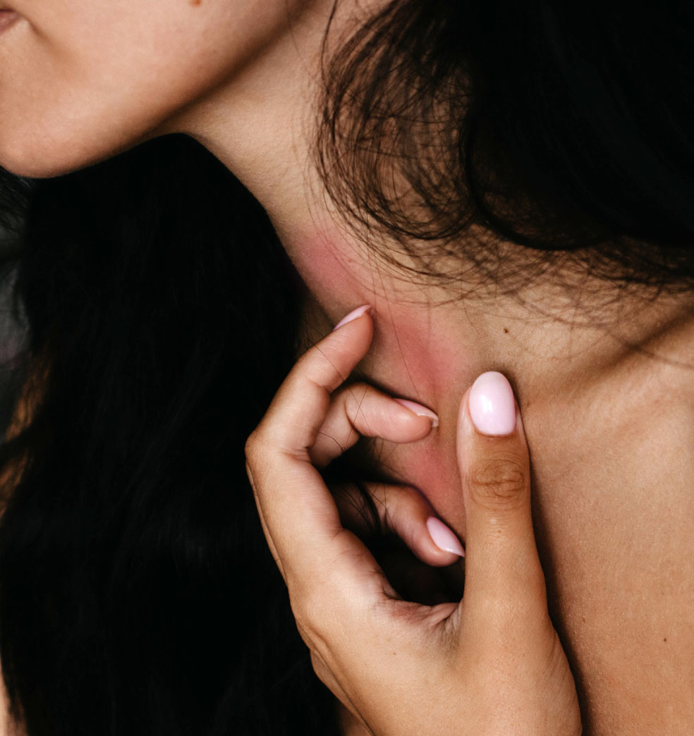 La alergia y las vacunas