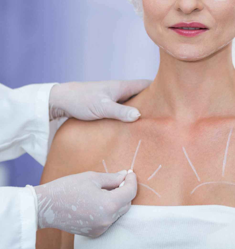 Levantamiento de mamas: Evaluación previa y recuperación?