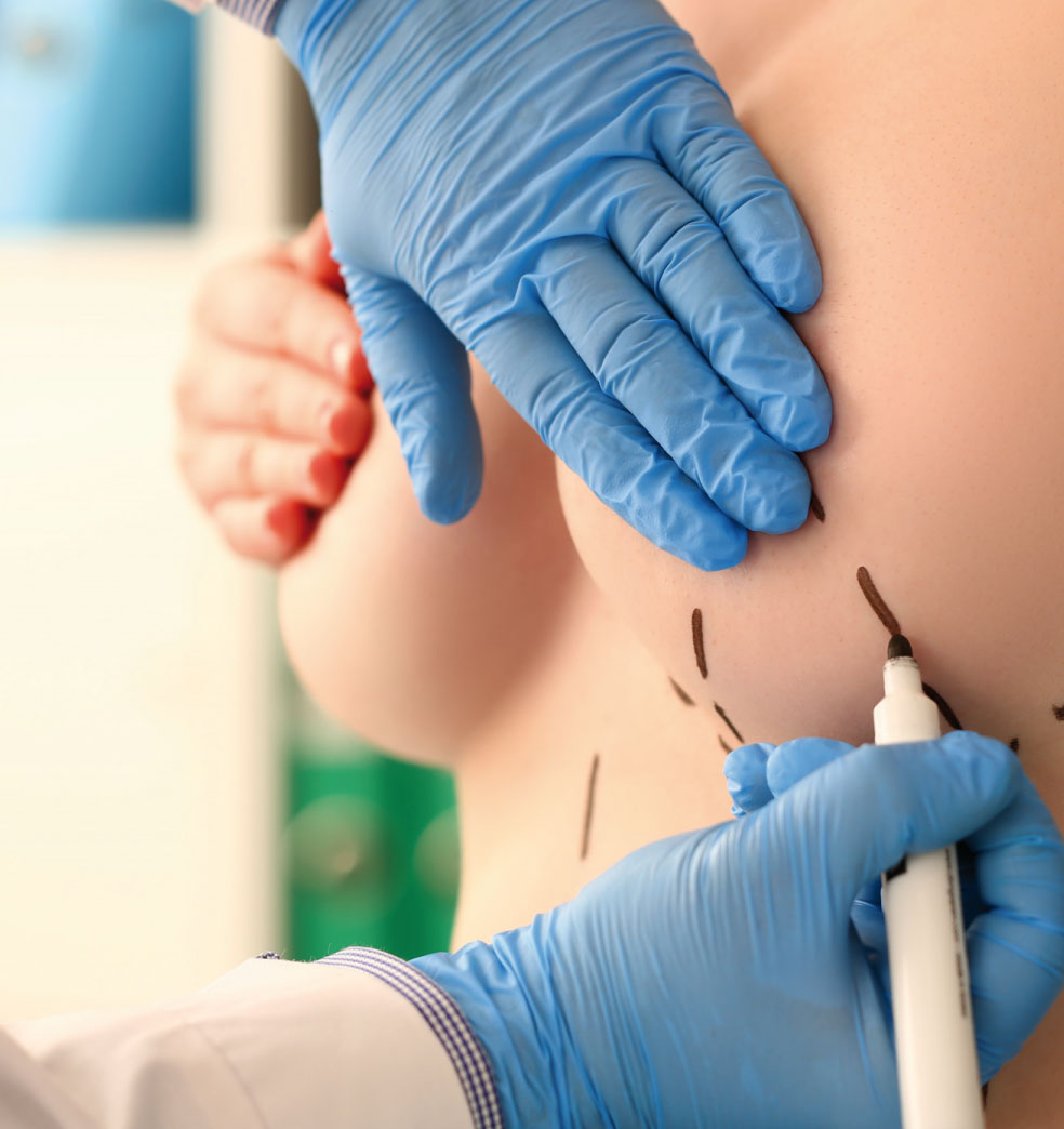 Reducción y levantamiento de mamas: Evaluación y procedimiento?