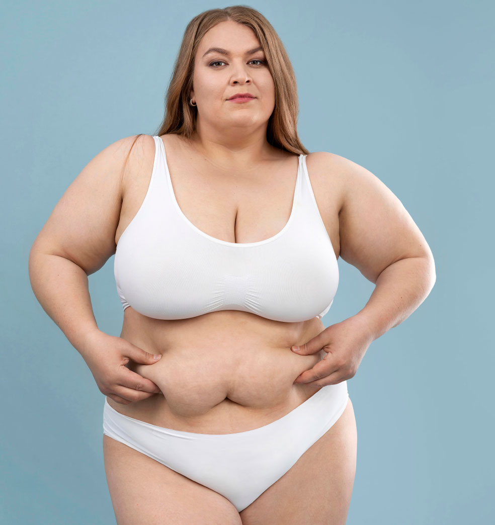 La obesidad: Qué puede producir y cómo combatirla