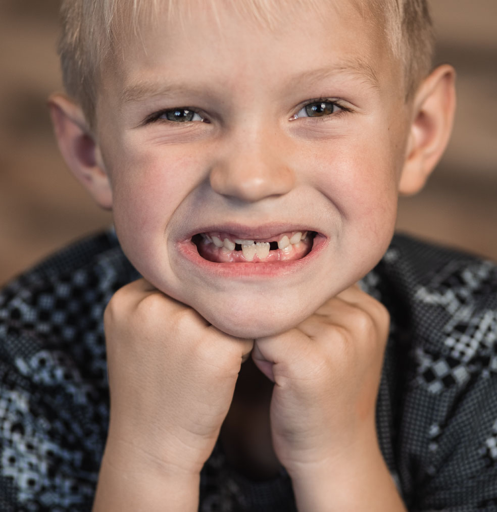 Por qué la edad de 7 años es ideal para la detección de problemas dentales 