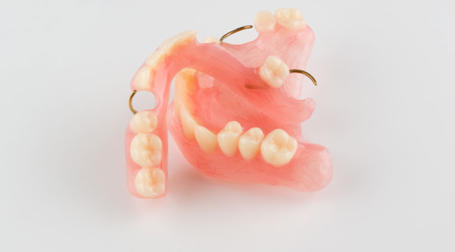 Qué es mejor: ¿Implantes o prótesis dentales?