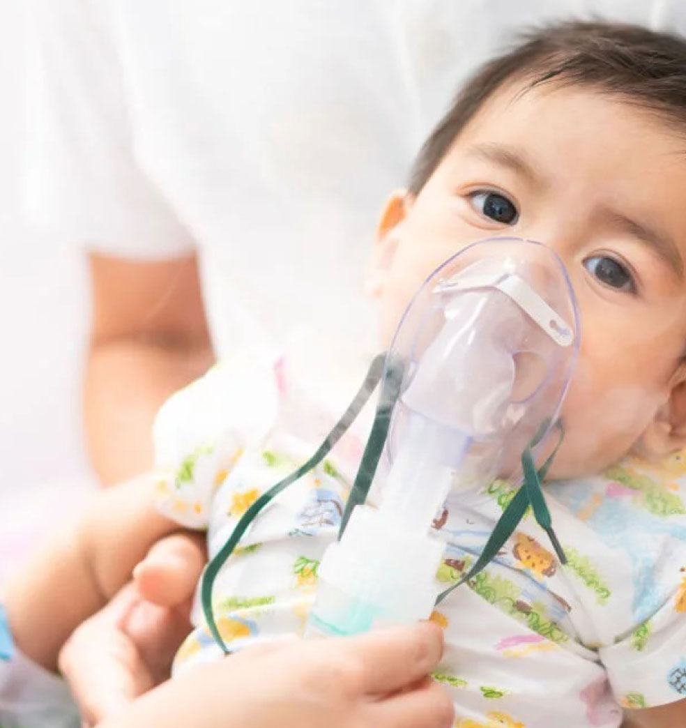 Virus sincitial respiratorio